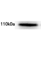 DSRAD Antibody
