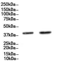 TMOD1 Antibody