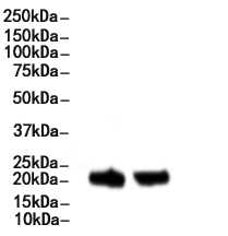 MRPL11 Mouse Monoclonal Antibody