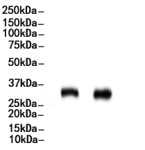 Nucleophosmin Antibody