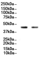 RRM2 Antibody