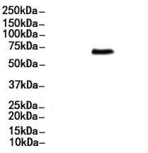 TGFBI Antibody 