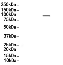 Phospho-PKD2 (Ser812) Antibody