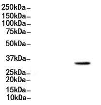CD20 Antibody
