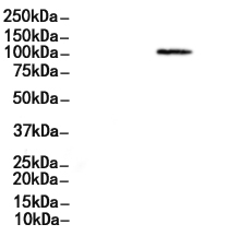 PHF20L1 Antibody