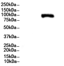 RRM1 Antibody