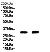UCP1 Antibody