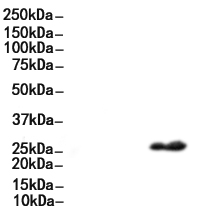 Phospho-CD79A (Tyr199) Antibody