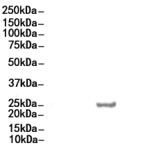 CD79A Mouse Monoclonal Antibody