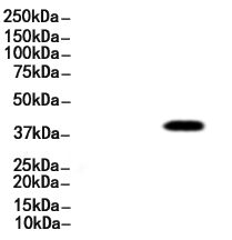 MAGEC2 Antibody