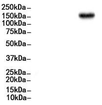 MSH6 Antibody