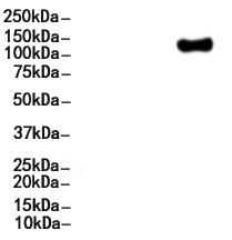 PDGF Receptor beta Antibody