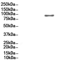 MTA1 Antibody
