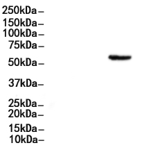 Phospho-TPH2 (Ser19) Antibody