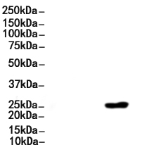 CD79A Mouse Monoclonal Antibody