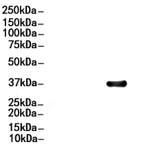 AQP4 Antibody
