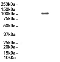 Phospho-Retinoblastoma (Ser807) Antibody