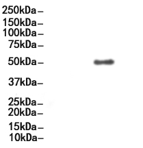 Cytokeratin 7 Antibody