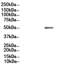 Phospho-BLNK (Tyr96) Antibody 