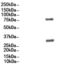 Phospho-MARCKS (Ser159) Antibody