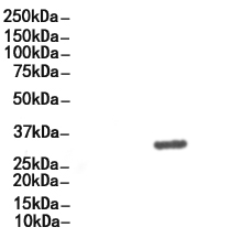 MARCKS Antibody 