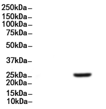 EBAG9 Antibody 