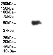 Phospho-IRF4 (Tyr122/Tyr125) Antibody