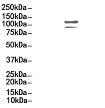 Phospho-PSD95 (Tyr236/Tyr240) Antibody