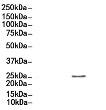 Galectin 3 Antibody