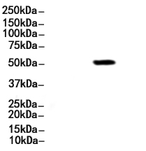 Phospho-GFAP (Ser38) Antibody