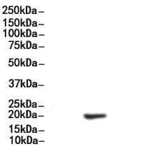 Phospho-CD3 zeta (Tyr142) Antibody