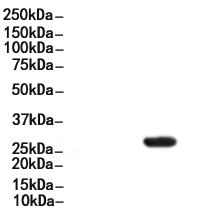 Phospho-RPS6 (Ser244) Antibody