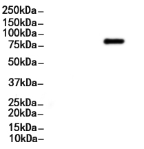 Phospho-TBK1 (Ser172) Antibody