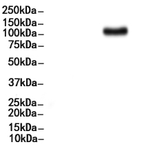 Phospho-FGFR1 (Tyr654) Antibody