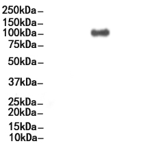 Cleaved-Notch 1 (Val1744) Antibody