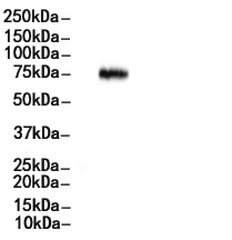 Phospho-p70 S6 Kinase (Thr389/Thr412) Antibody