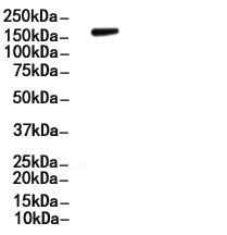 Phospho-EGFR (Tyr1173)[Tyr1197] Antibody
