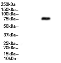 Phospho-ALK (Tyr1507) Antibody
