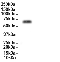 Phospho-NF-kB p65 (Ser536) Antibody 