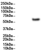 Phospho-AKT1 (Thr308) Ab